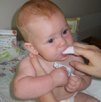 Молочница у детей обработка рта