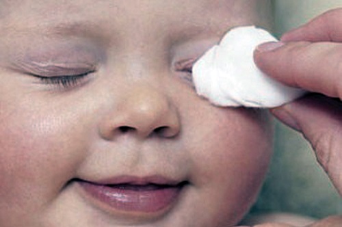 Лавровый лист от аллергии у ребенка