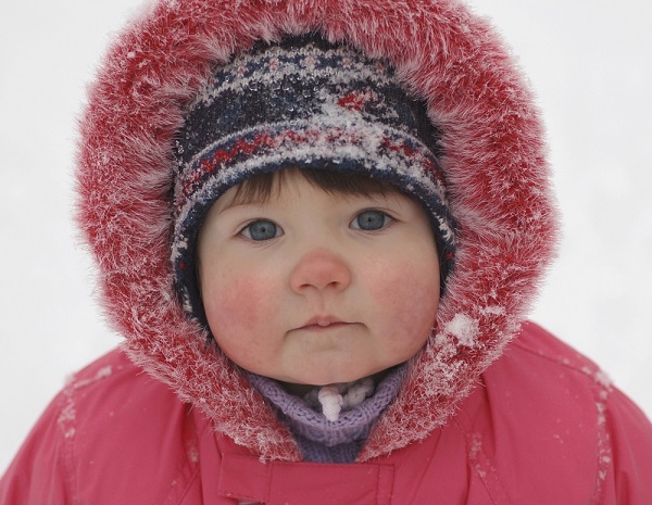 Аллергия на холод у ребенка