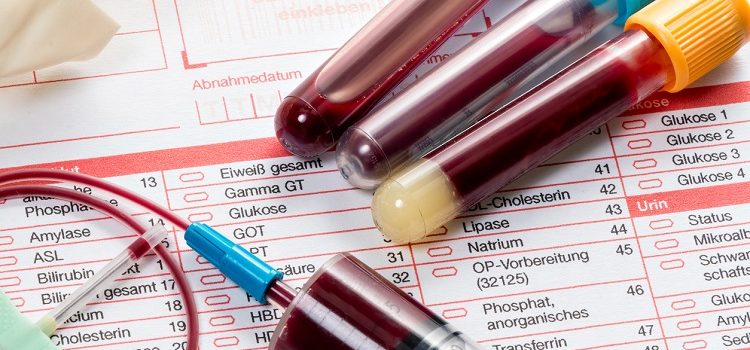 Анализ крови вместо Манту и другие методы диагностики туберкулеза у ребенка