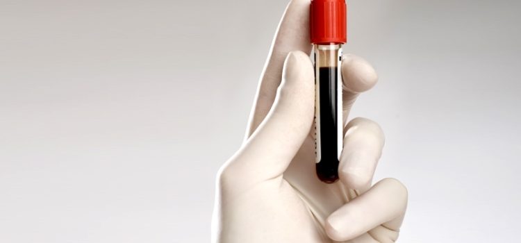 Эритроциты в крови у ребенка повышены: почему это бывает и что нужно делать