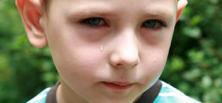 Красные круги, мешки под глазами у ребенка, покраснели верхние или нижние веки: насколько опасны такие симптомы?
