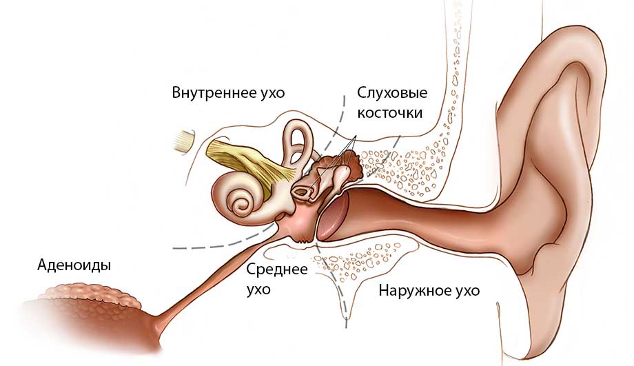 Отит среднего уха: симптомы и лечение