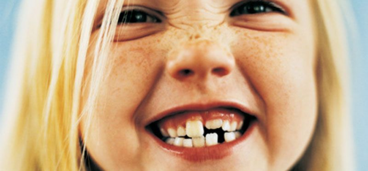 Приблизительный порядок и сроки прорезывания постоянных зубов у детей