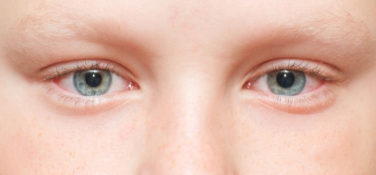 У ребенка болят глаза — разбираемся в причинах и сопутствующих симптомах