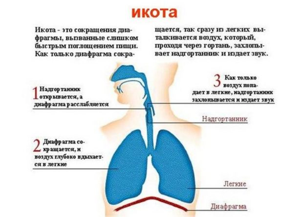 Икота у новорожденных — 7 причин возникновения и что делать родителям