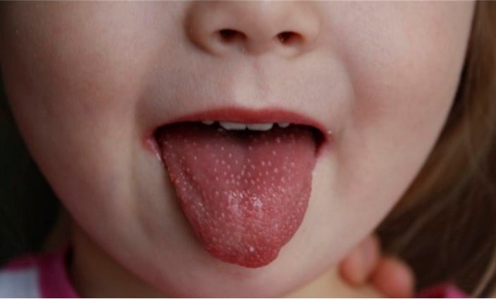 Как определить недостаток витамина B12 у ребенка: рекомендации ученых 💊