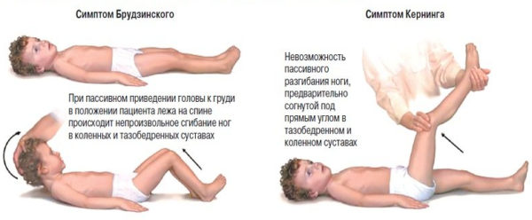 Лечение менингита у детей, причины и симптомы