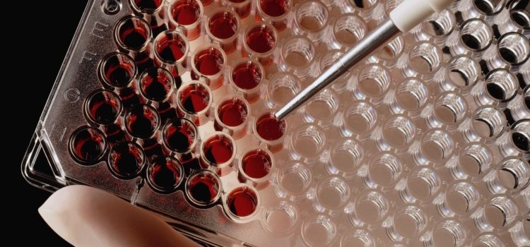 Пониженные лейкоциты в крови у ребенка: с чем это связано и что делать родителям