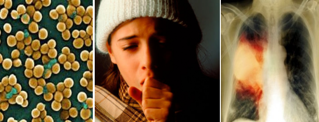 Пневмония у детей, ее симптомы и методы лечения